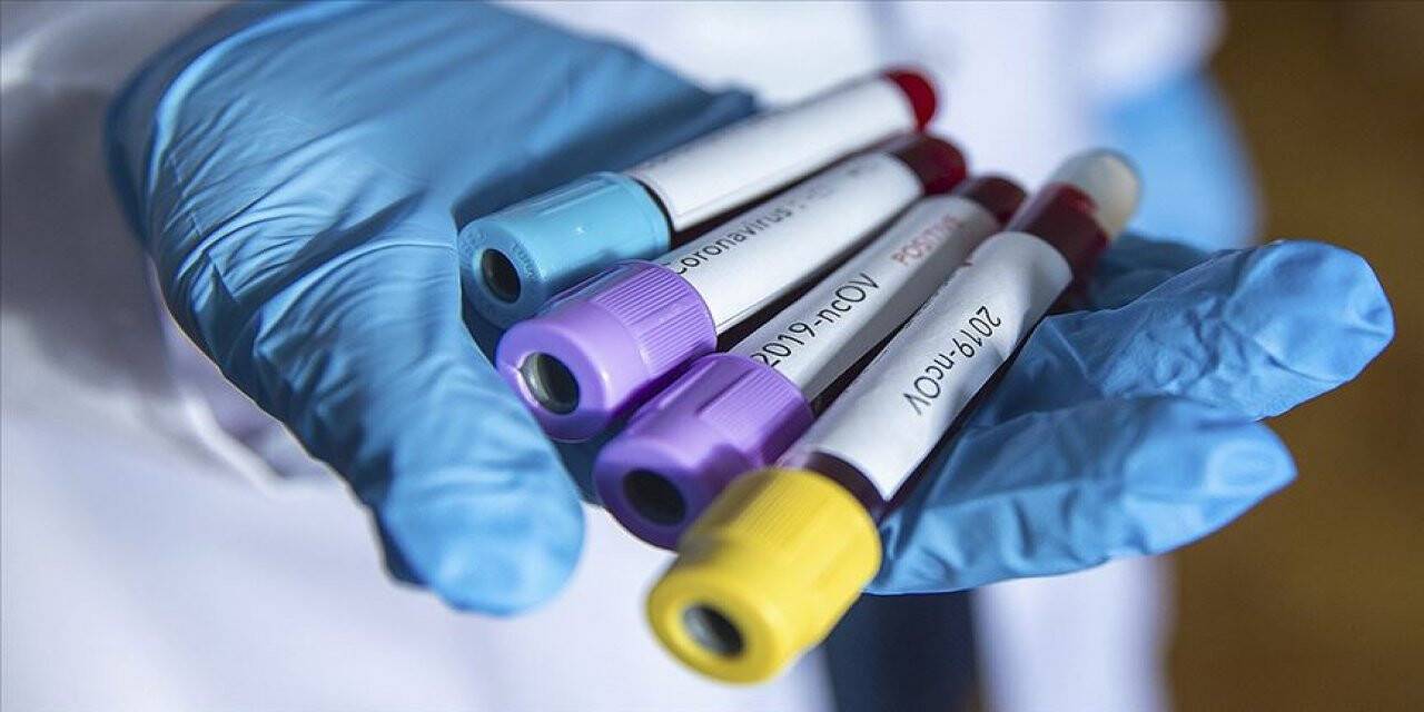 İcra katibinin Kovid-19 testi pozitif çıktı