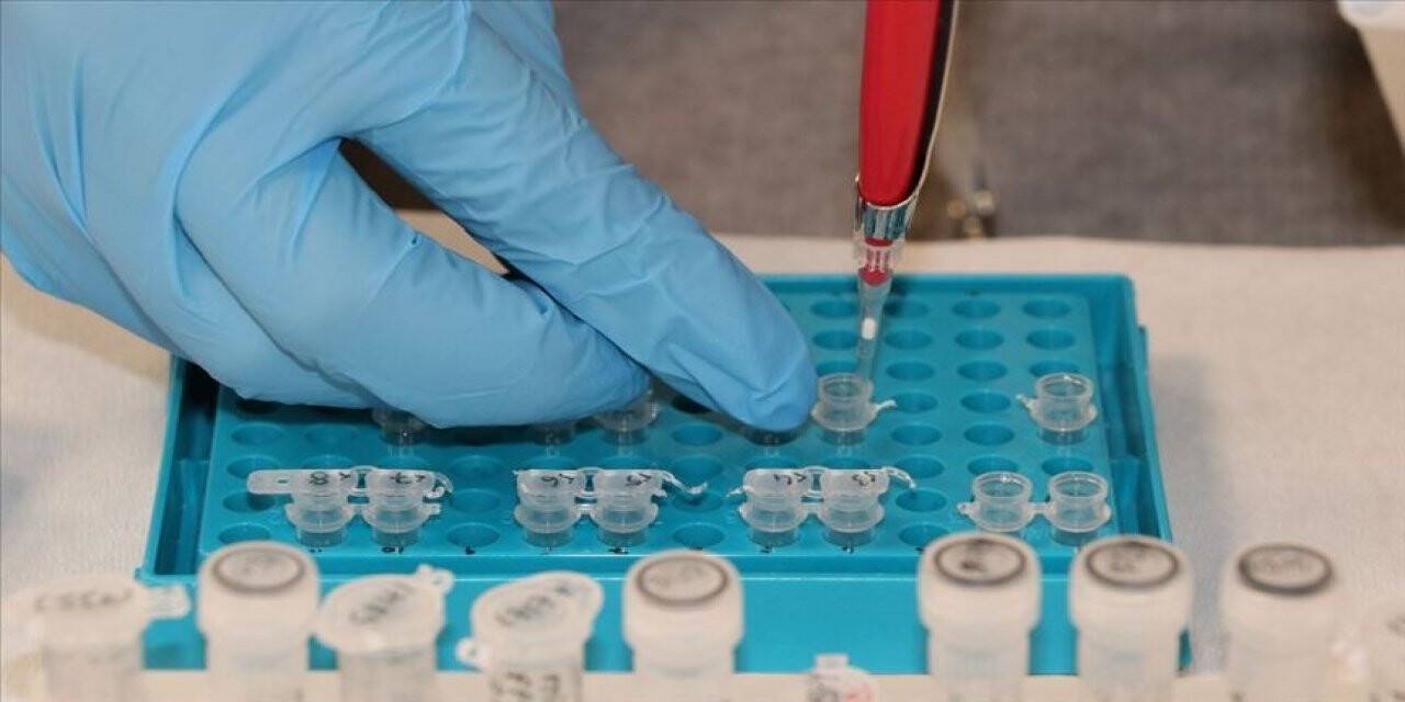 Yüksek kortizol seviyesi Kovid-19 hastalarında ölüm riskini artırabilir