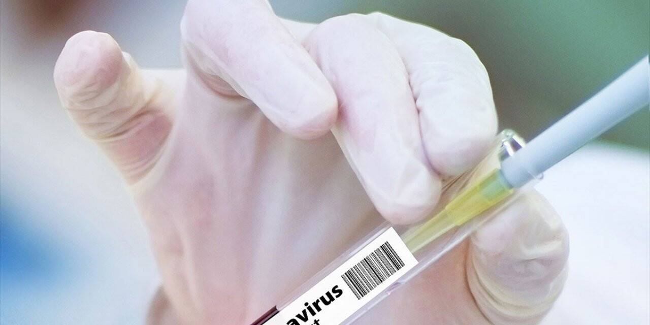Kovid-19'a karşı yeni aşı adayının klinik denemelerine başlandı