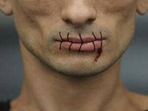 Dudaklarını Birbirine Dikti!