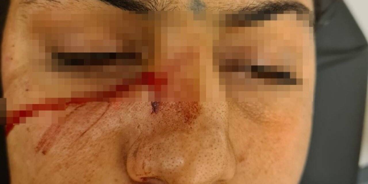 Adana'da dini nikahlı eşini darbedip bıçaklayan koca tutuklandı