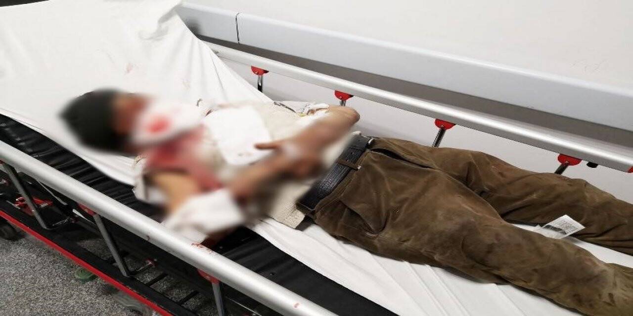 Misafirliğe gitti dehşeti yaşadı! Köpek saldırısında ağır yaralanan yaşlı adam Konya'da tedavi altında