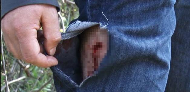 Şişli'nin göbeğinde 3 köpek baba kıza saldırdı
