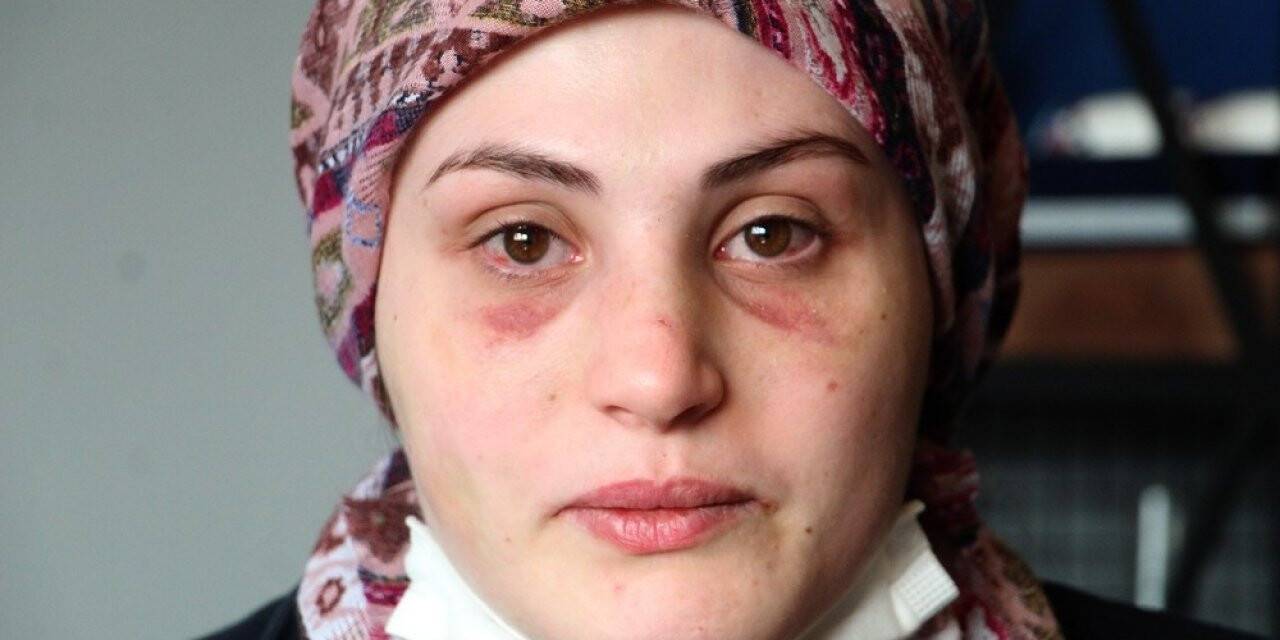 Kaçarak evlendiği eşi, genç kadına kabusu yaşattı