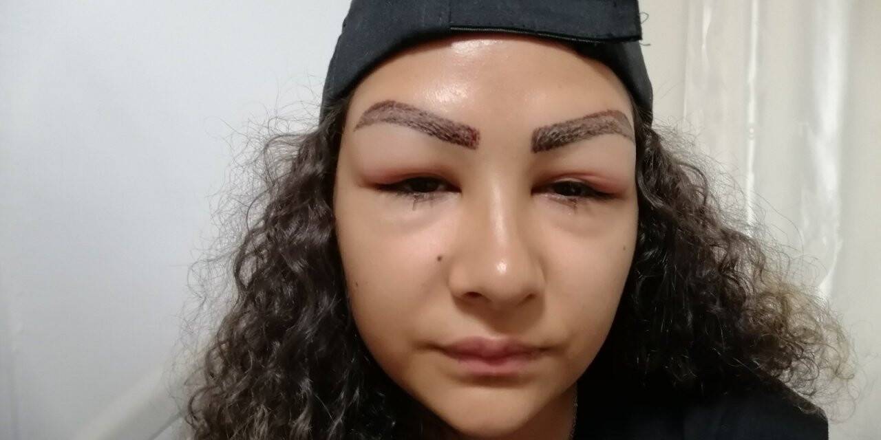 Reklam yüzü olmak için gitti, yüzünden oldu