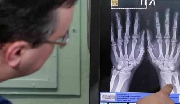 Bilim kurgu filmlerindeki çipler gerçek oldu