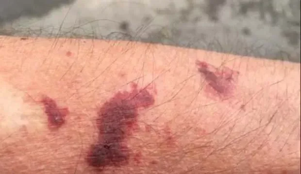 Karadeniz'de selden sonra yeni tehlike!
