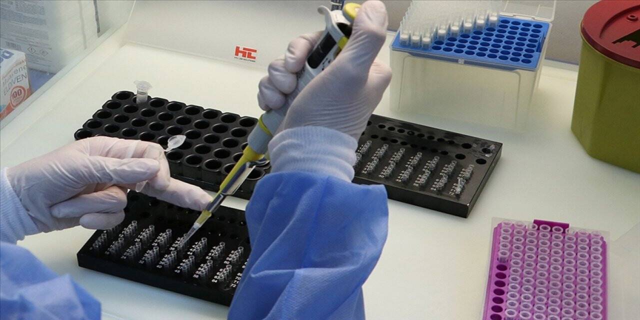 Pcr sistemi alınacak