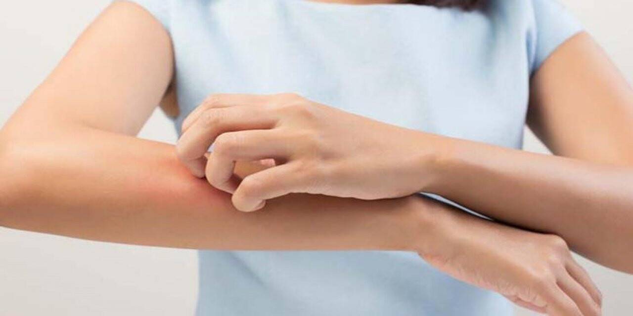 Mevsim geçişlerinde alerjik egzamaya dikkat