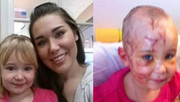 İnsan köpeği ısırdı!