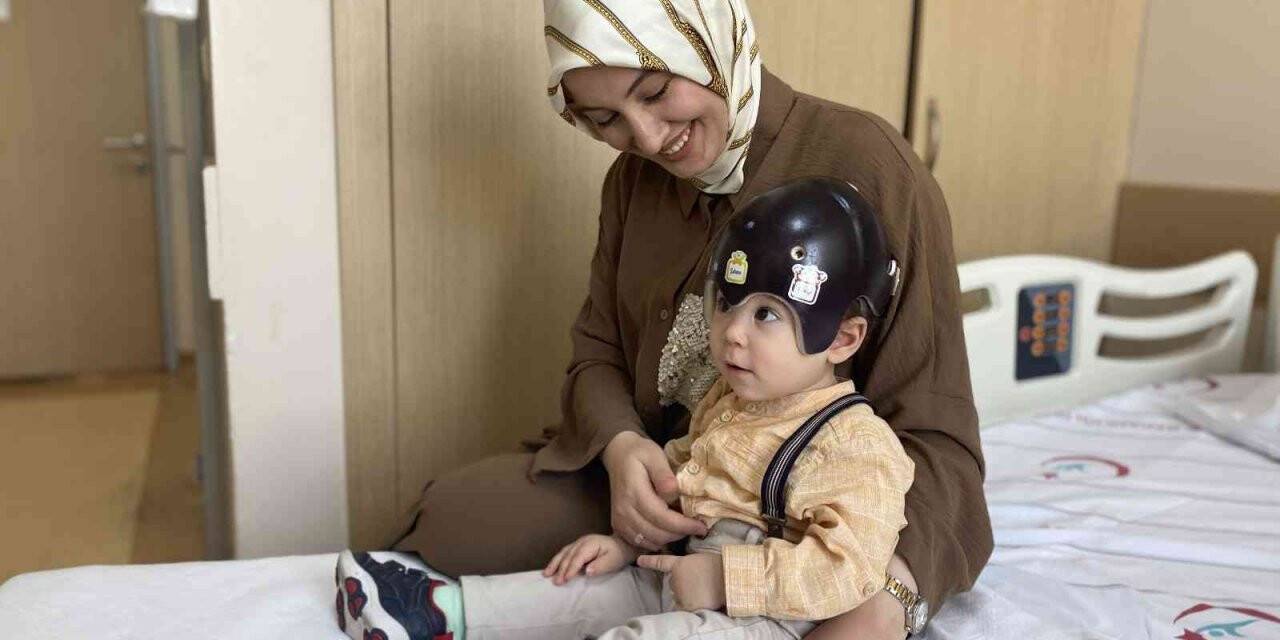 Bebeklerde kafatası şekil bozukluğuna dikkat!