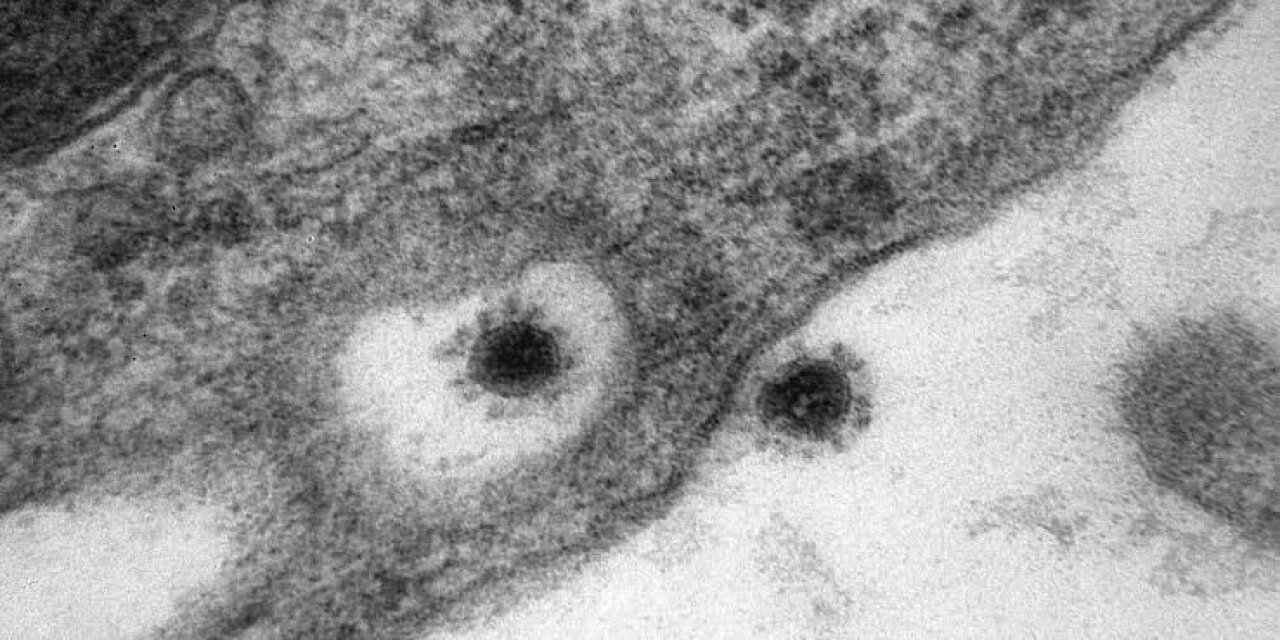 Rusya’da koronavirüsün Delta Plus mutasyonu görüntülendi