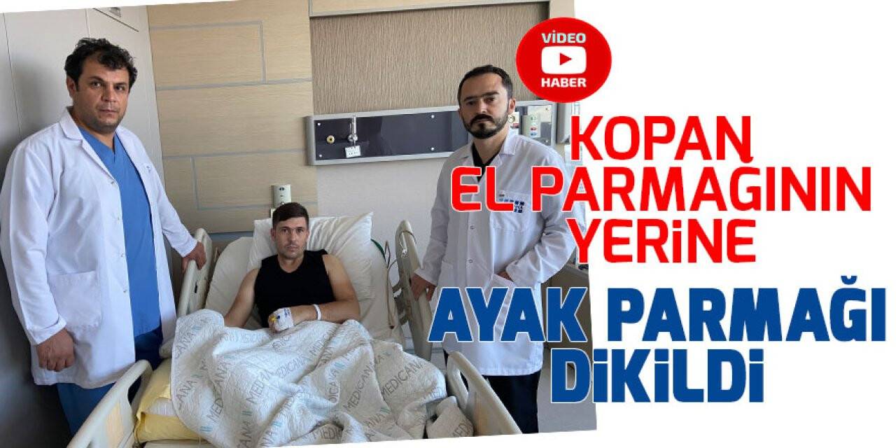 Kopan el parmağının yerine ayak parmağı dikildi