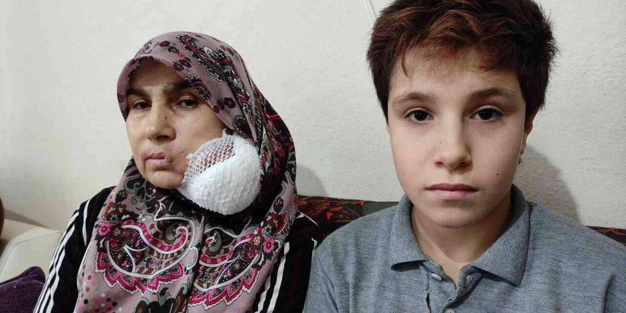 Yüzündeki dev kitleden kurtulmak için yardım bekliyor