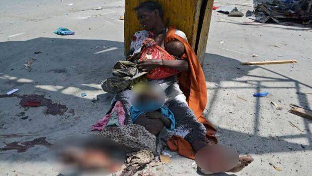 Somali'den dehşete düşüren kareler