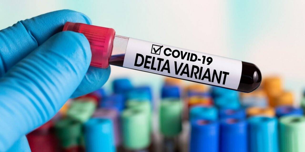 KKTC’de görülen COVID-19 vakalarının yüzde 90’ı Delta varyantı kaynaklı