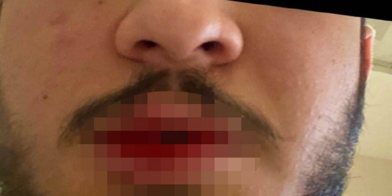 Kars’ta sağlık çalışanı darp edildi