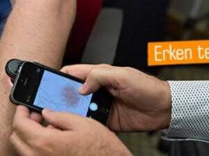 Cilt Kanserini Bulan Uygulama