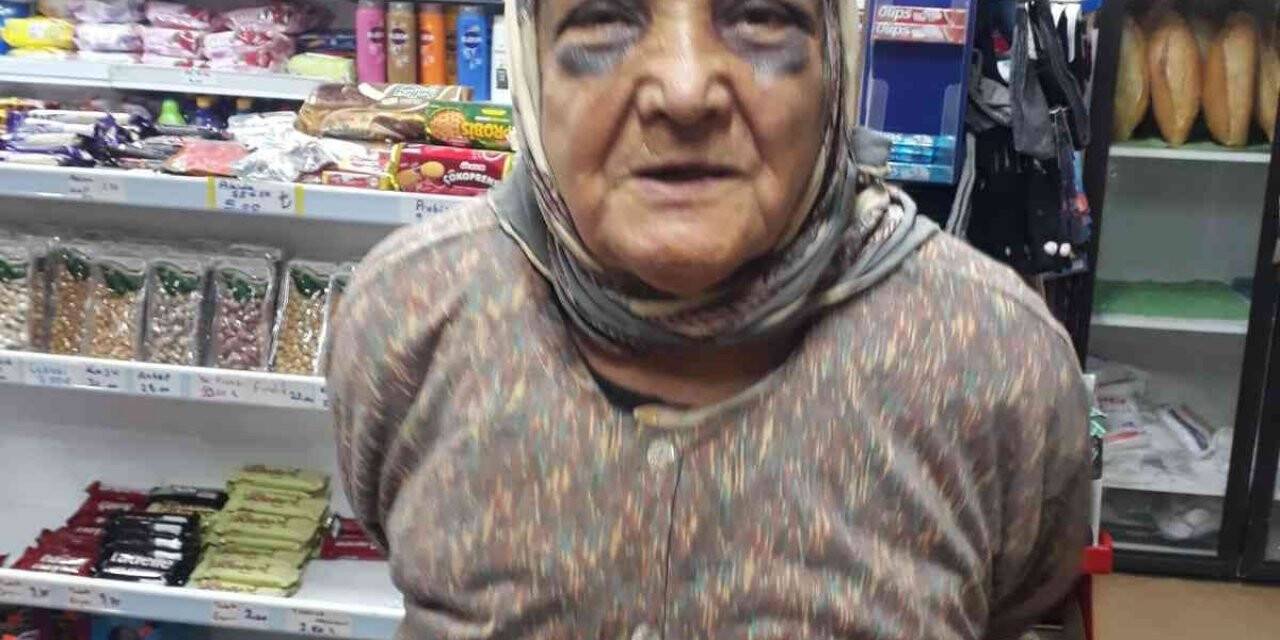 Demir çubukla dövdüğü 73 yaşındaki eşini, bakın ne hale soktu