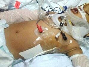 11'inci Kattan Düşen Bebek Ölmedi