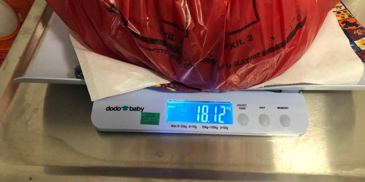 Karın şişliği sandı, 18 kiloluk kitle çıktı