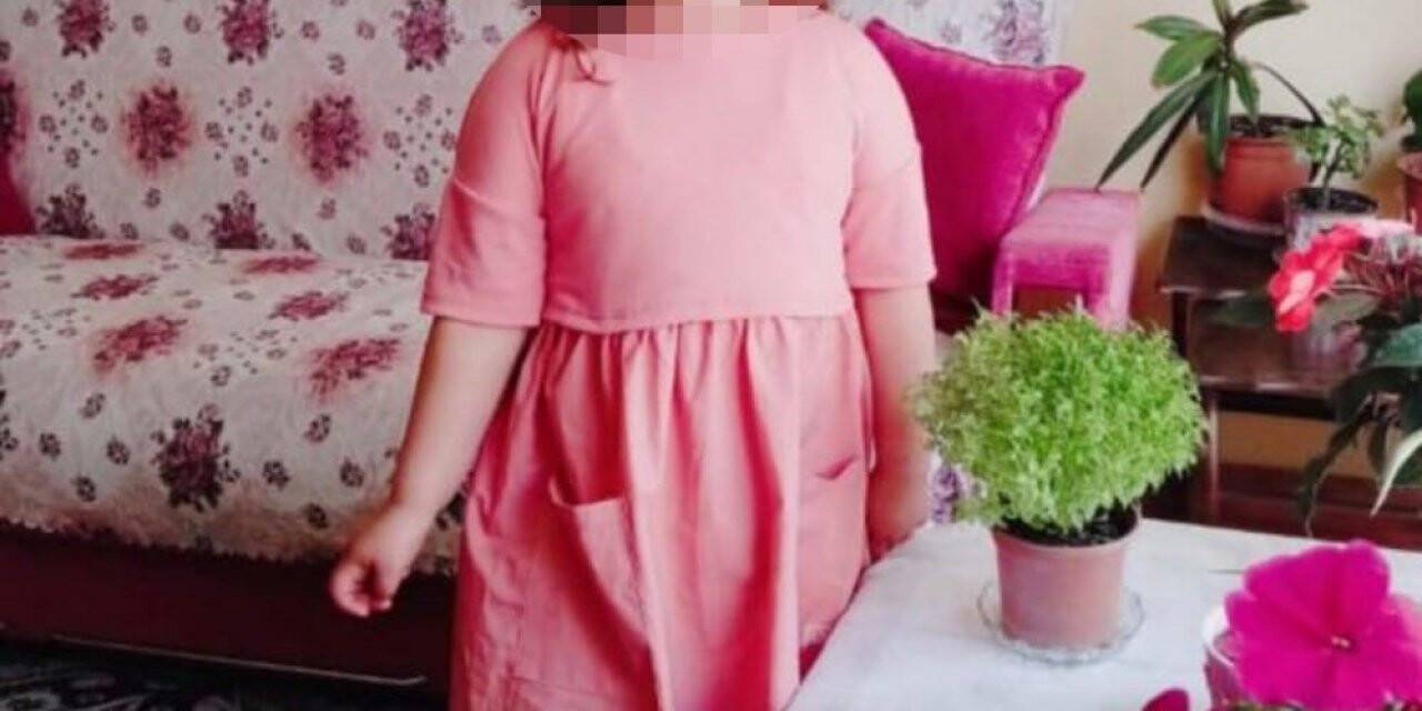 Küçük kızın vücudundaki morluklar iğrenç bir olayı ortaya çıkardı