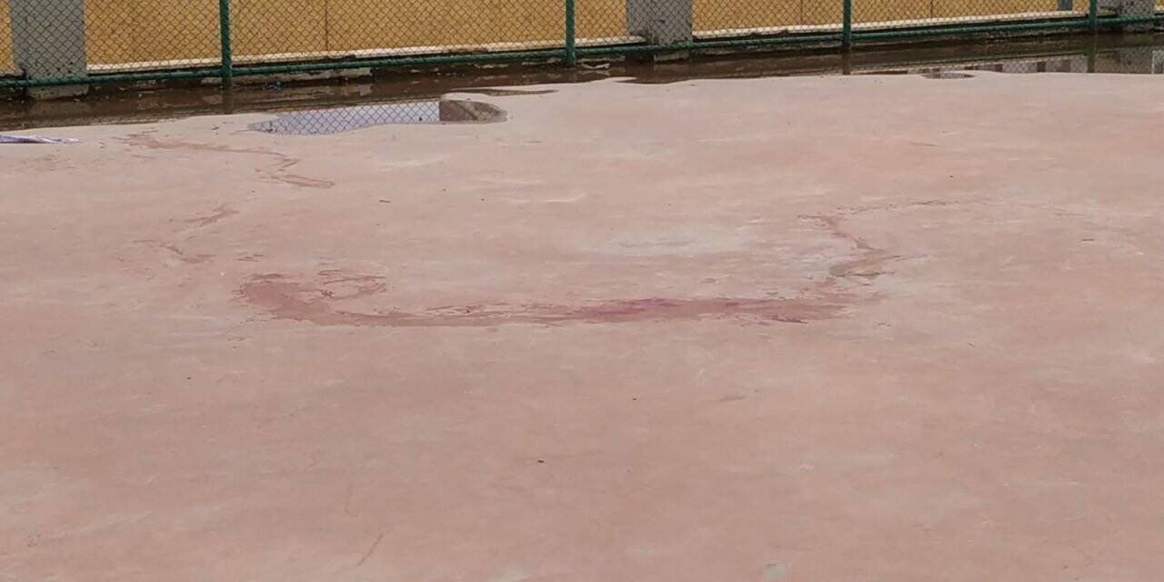 Pitbull cinsi iki köpeğin saldırdığı 4 yaşındaki çocuk ağır yaralandı