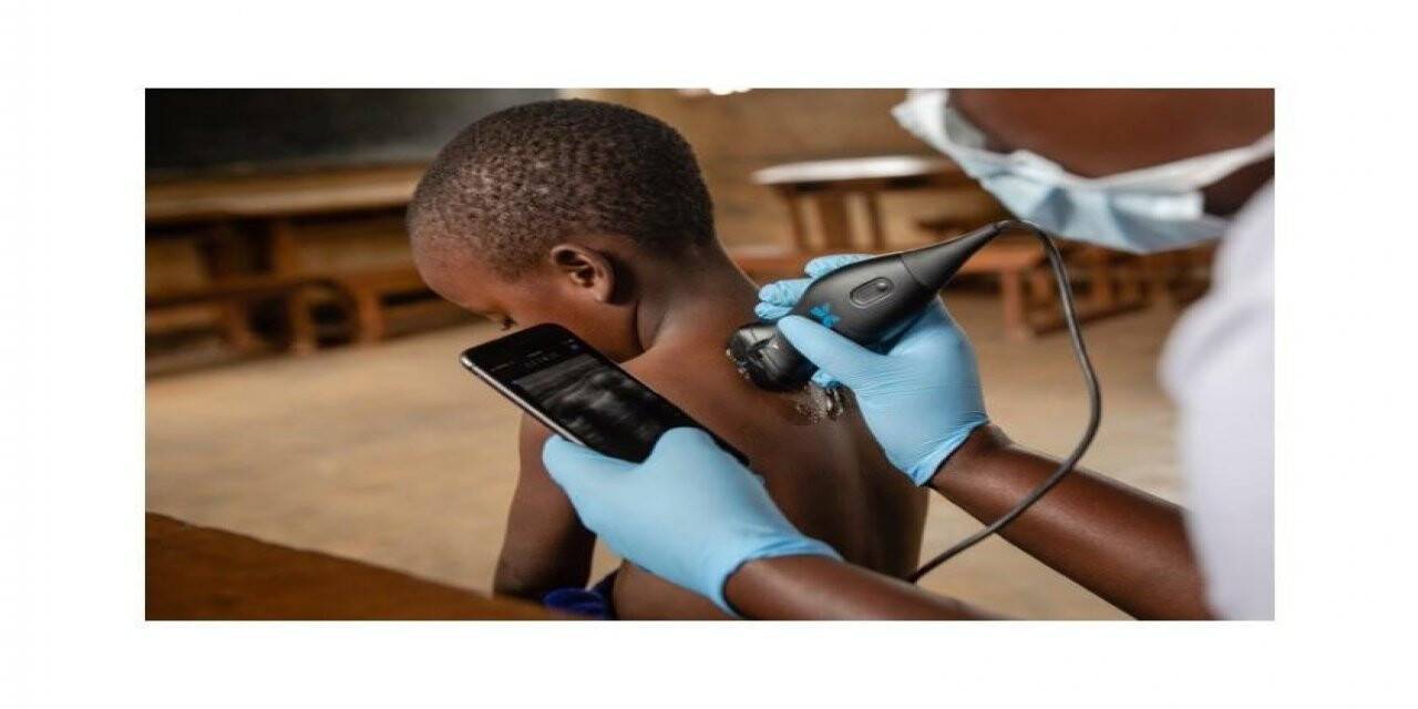 "Teknoloji sağlık hizmetelerini daha ulaşılabir ve eşit hale getiriyor"