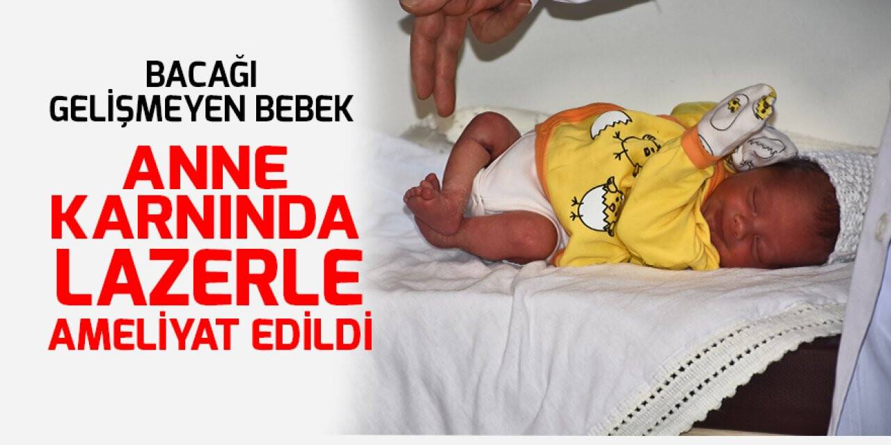 Bacağı gelişmeyen bebek anne karnında lazerle ameliyat edildi