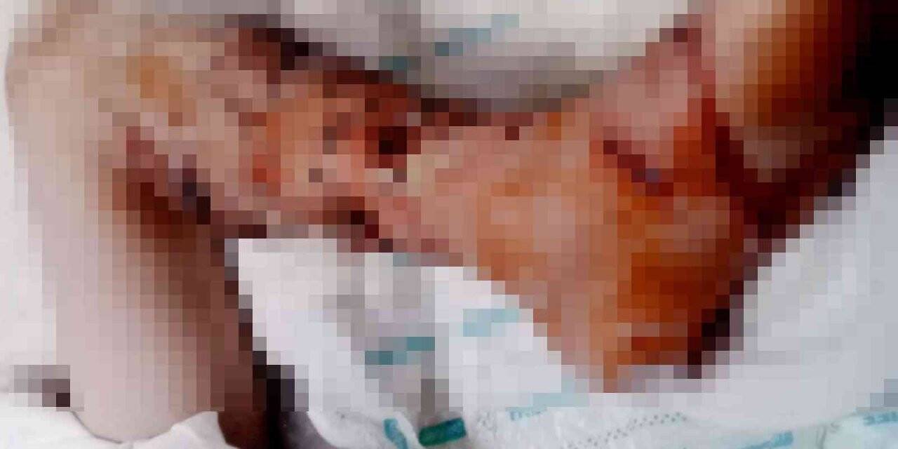 4 yıl önce pitbull saldırısına uğrayan çocuk, psikolojik tedavi alıyor