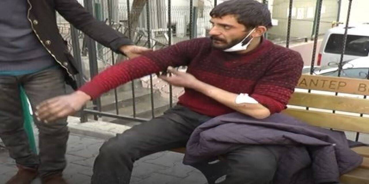 Gaziantep’te ikinci pitbull vakası