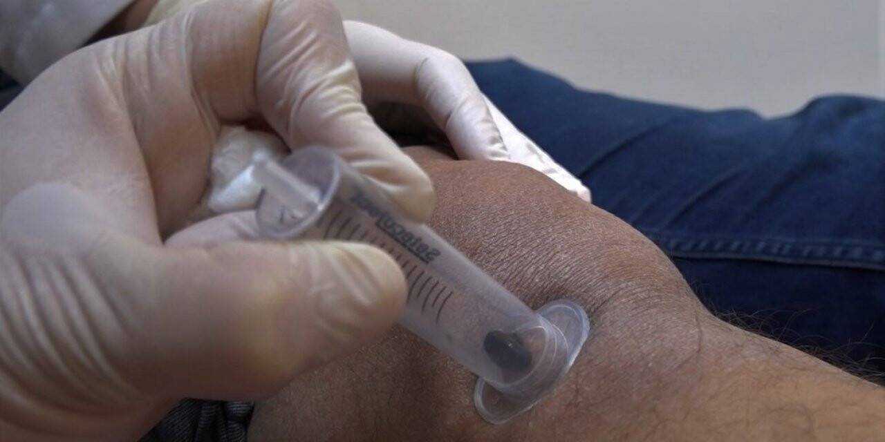 Doktor sülükler şifa kaynağı