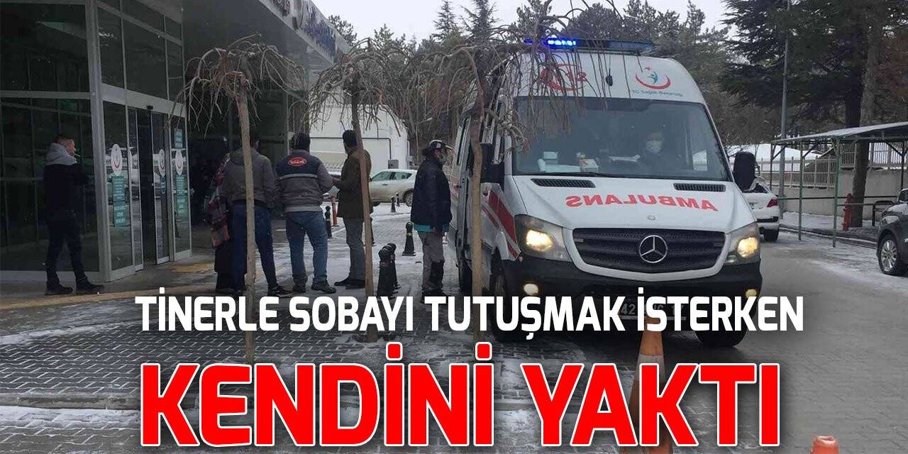 Tinerle sobayı tutuşmak isterken kendini yaktı