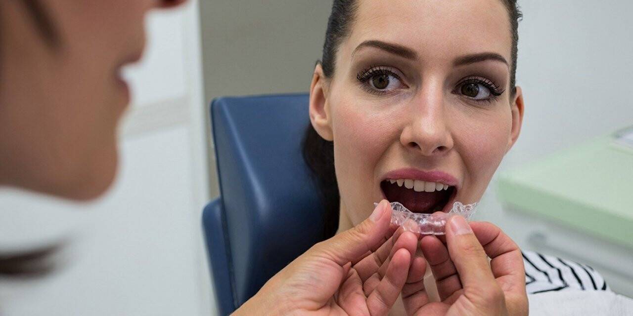 Ortodonti tedavisinde diş tellerinin yerini şeffaf plaklar alıyor