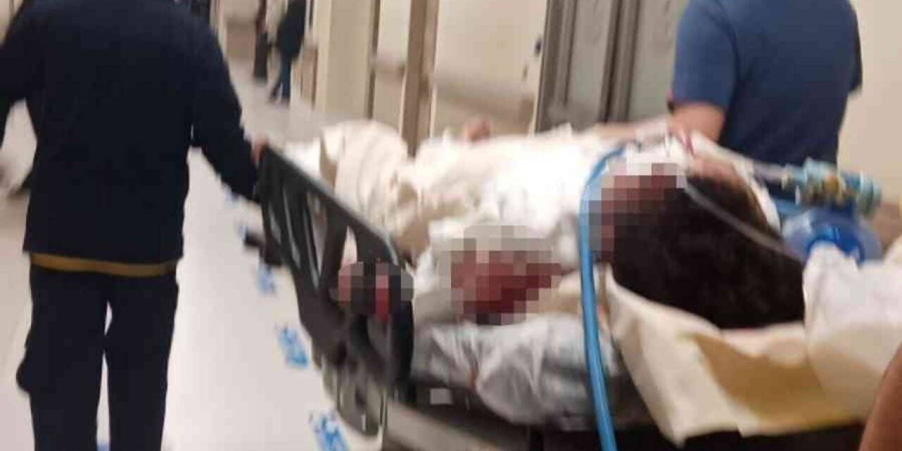 Üsküdar’da meydana gelen doğal gaz patlamasında yaralanan vatandaşın tedavisi yanık ünitesinde sürüyor