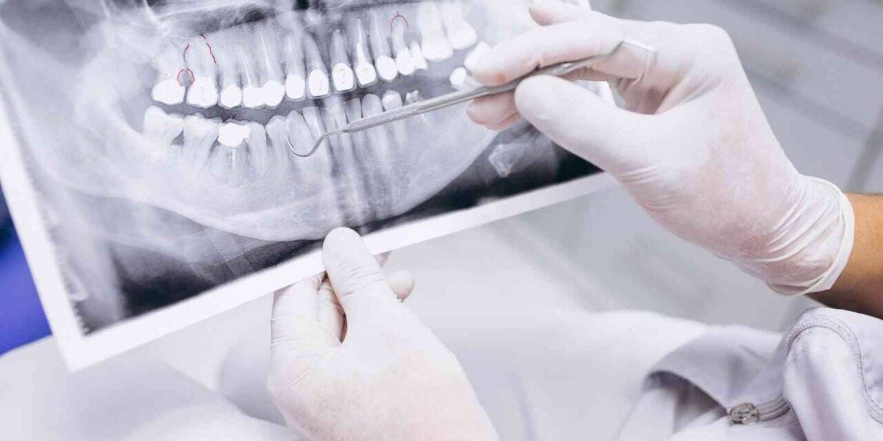 Sigara, diş tedavi sürecini olumsuz etkiliyor