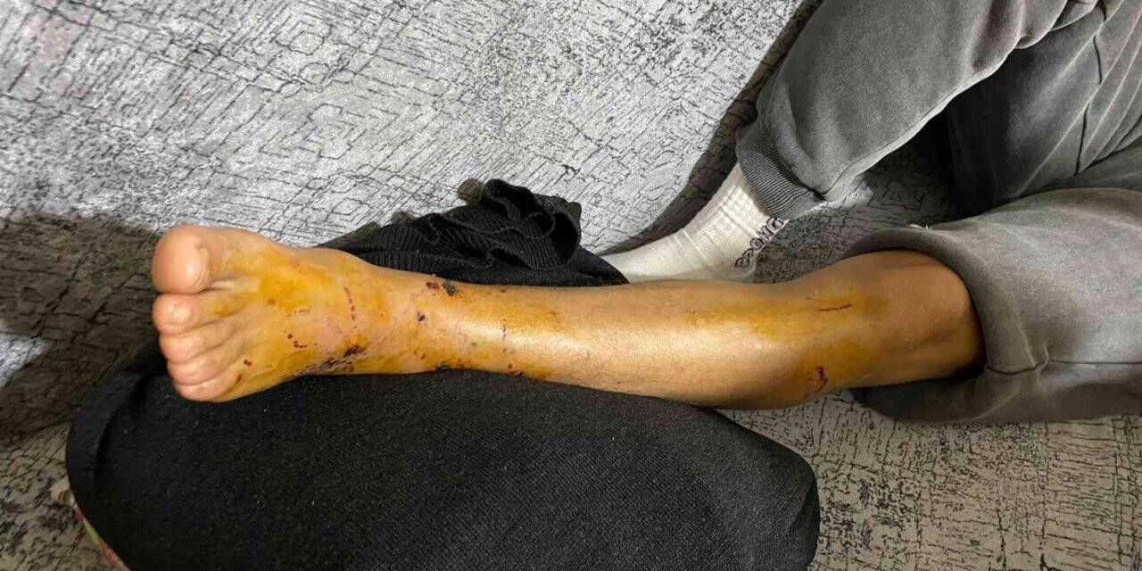 İstanbul’un göbeğinde pitbull dehşeti kamerada