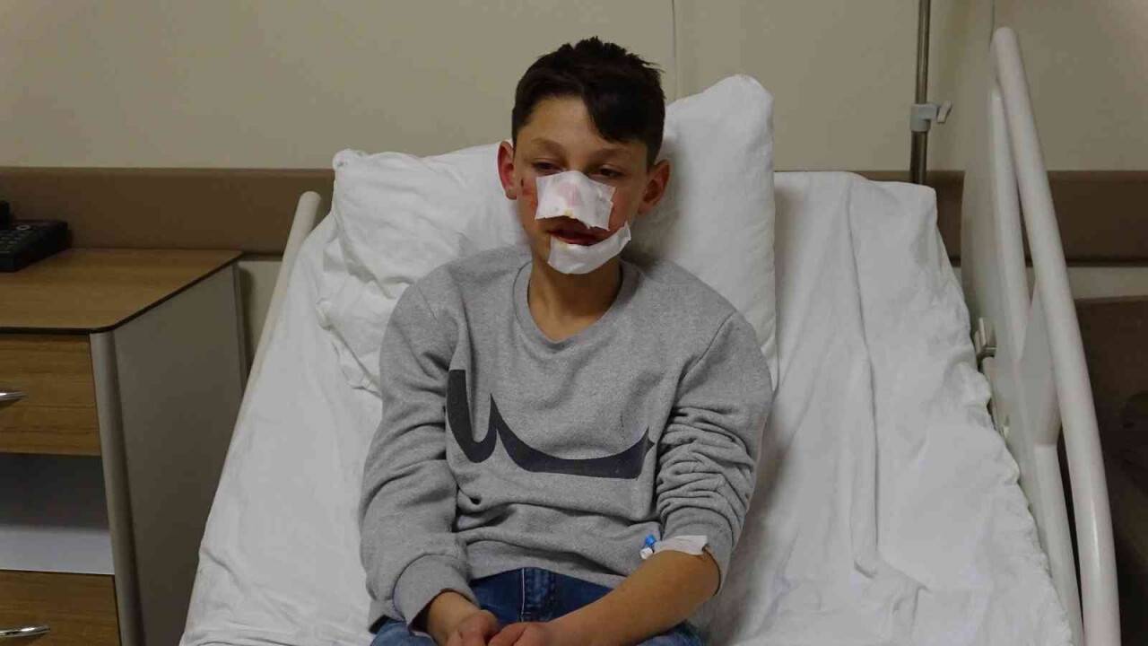 Köpek saldırısı ekmek almaya giden çocuğa dehşeti yaşattı