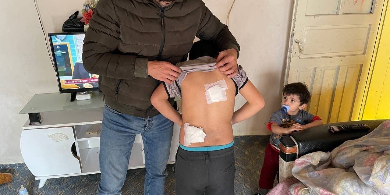 Okula giderken iki köpeğin saldırısına uğradı