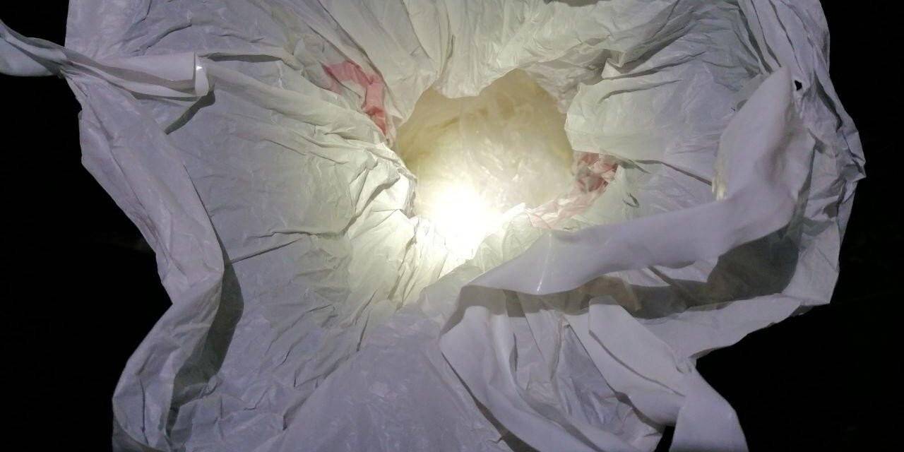 Yüz nakli yapılan Recep Sert gözaltına alındı