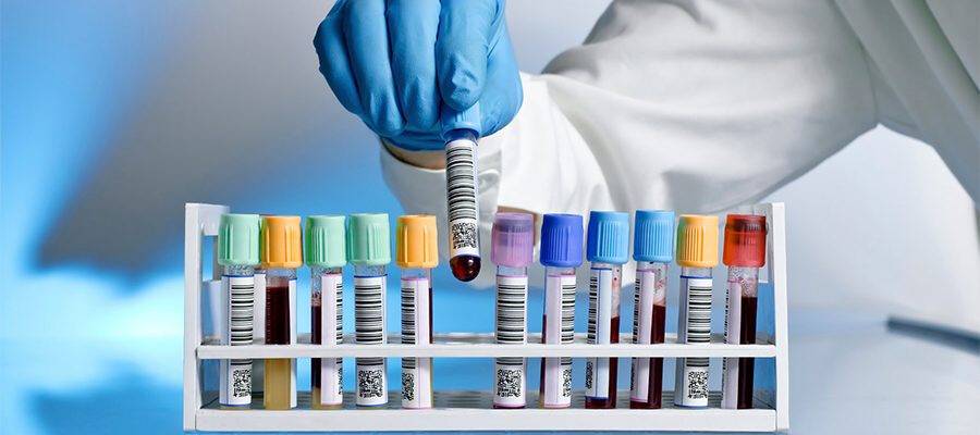 Laboratuvar hizmeti alınacak