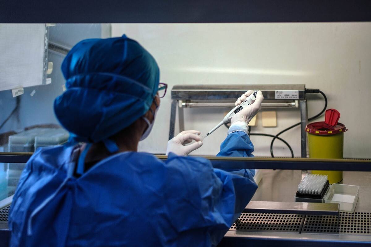 Son 24 saatte koronavirüsten 63 kişi hayatını kaybetti