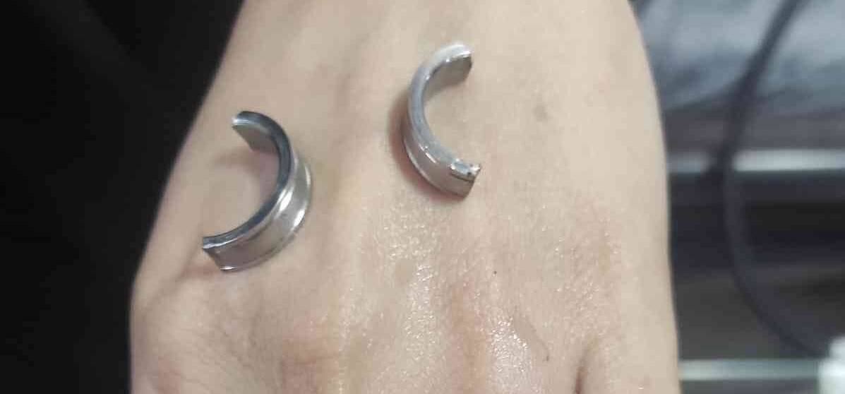 Parmağa sıkışan yüzüğü itfaiye ekipleri çıkardı