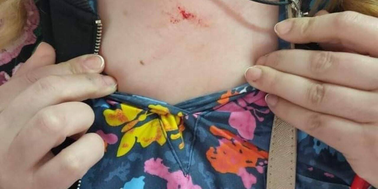 Kayseri’de Ebeler Haftası’nda ebeye şiddet