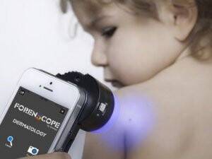 Cep Telefonu İle Cilt Kanserine Erken Teşhis!