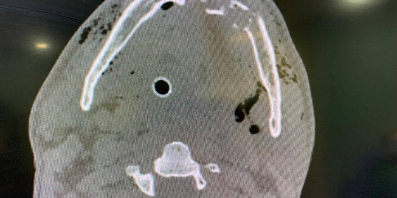 Silahla yaralanan Tarkan Özer’e hayata döndüren müdahale