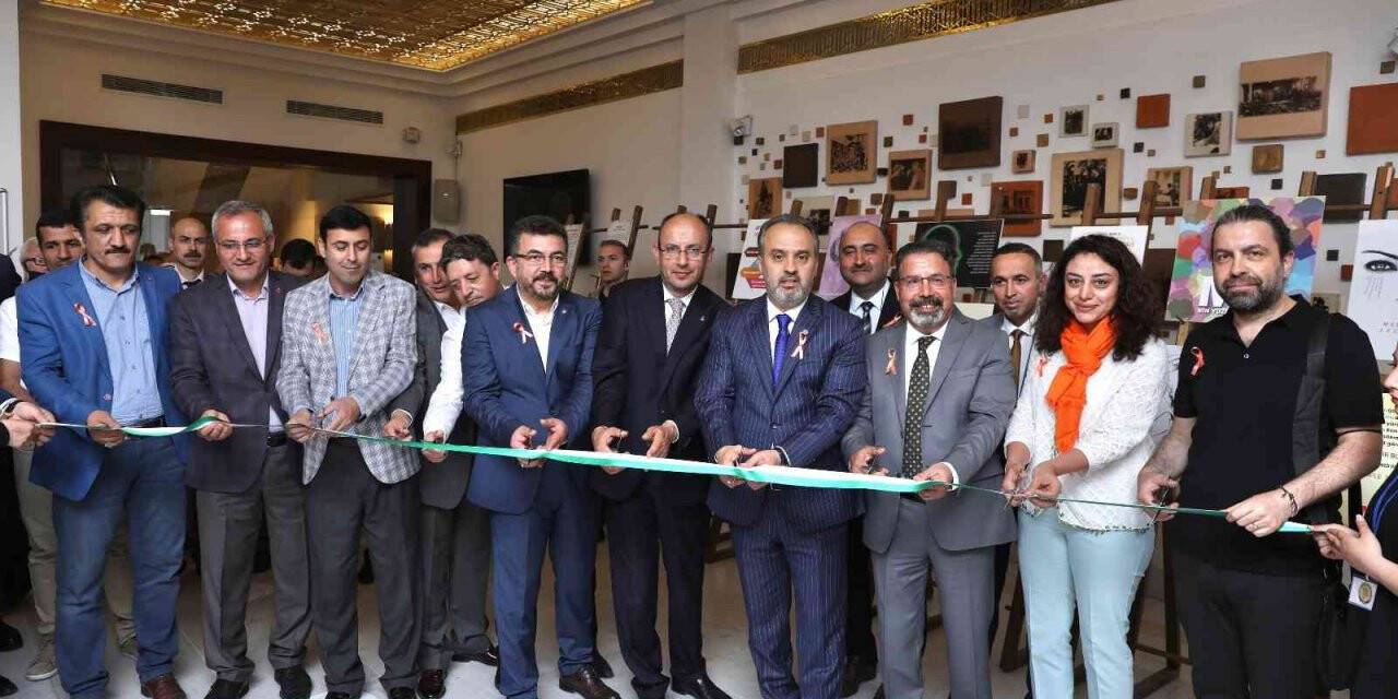 MS duyarlılığı sergisi