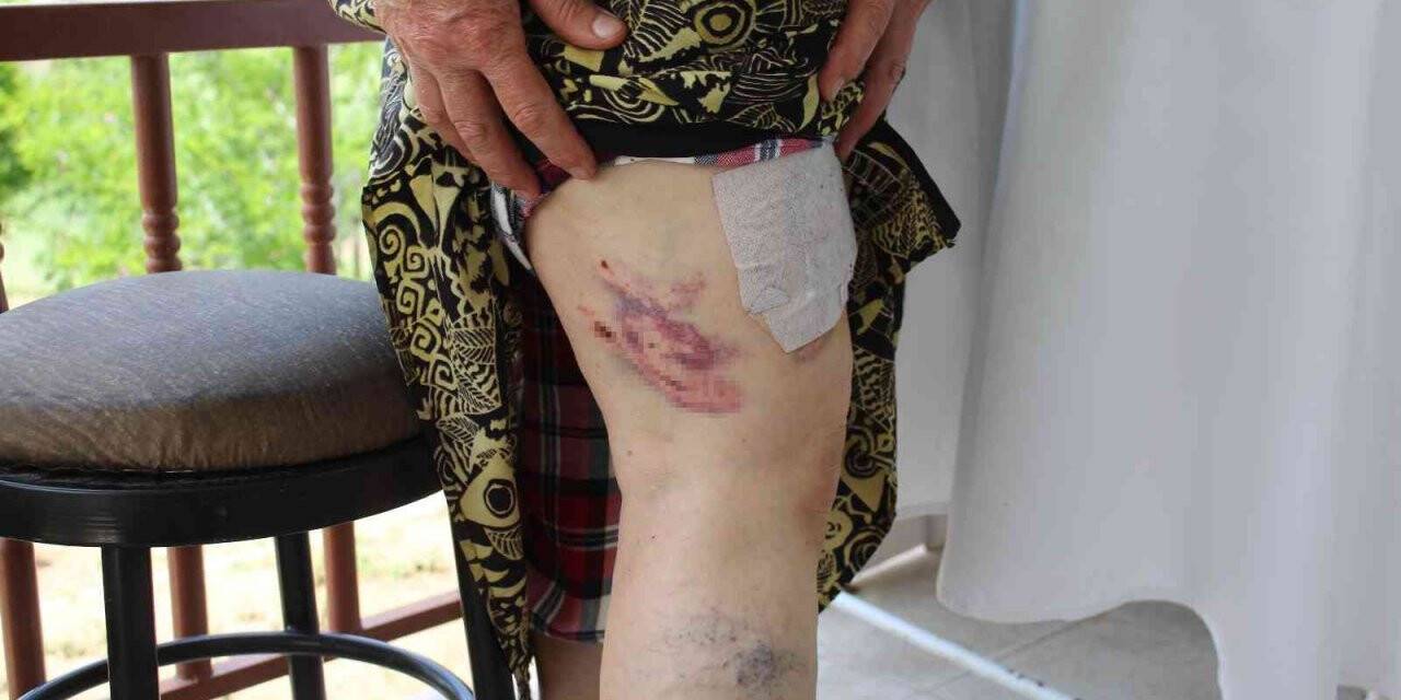 Başıboş köpeklerin saldırdığı yaşlı kadın ölümden döndü