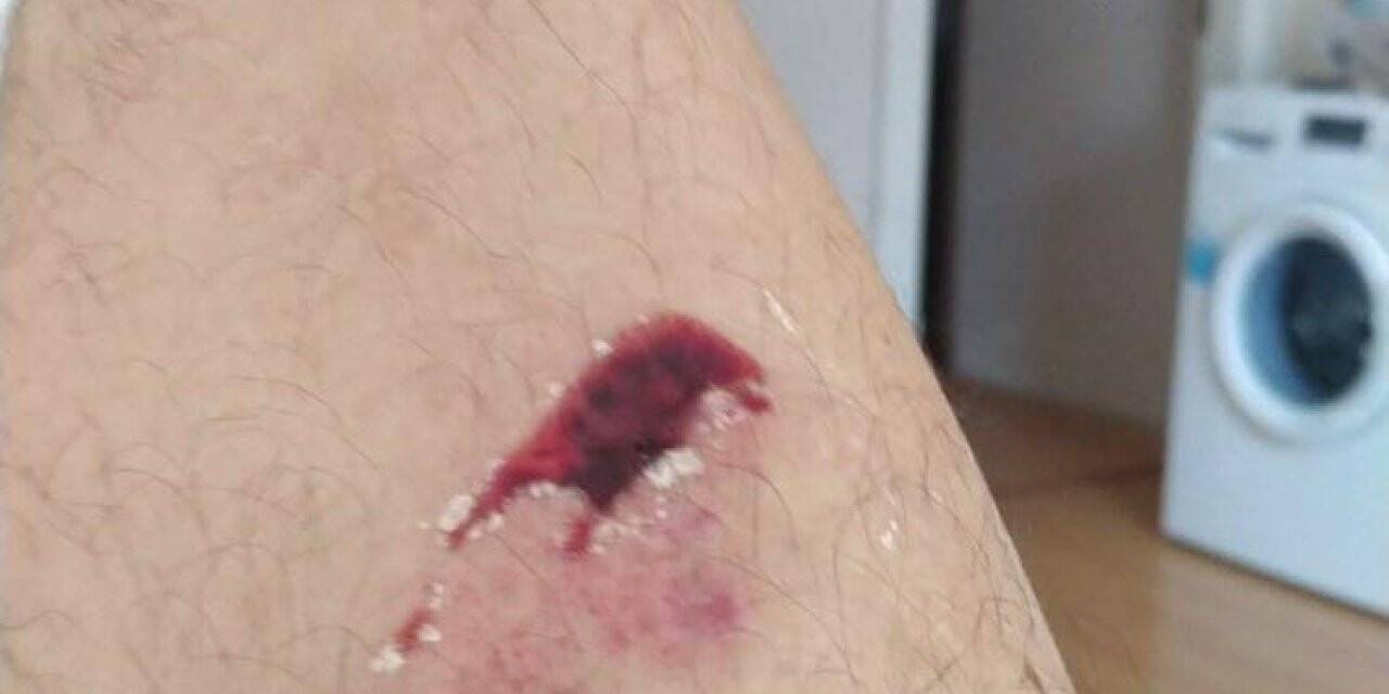 Hırsızı yakalamak isterken ayağından yaralandı