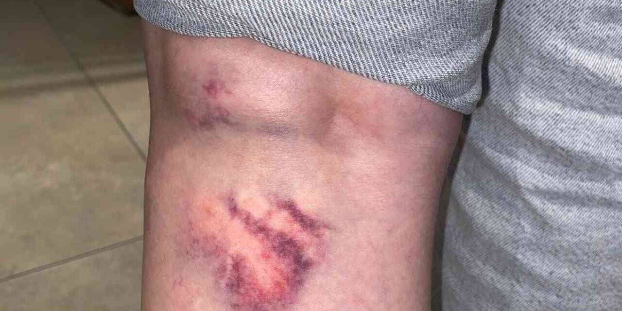 29 yaşındaki Hasret, sokakta dehşeti yaşadı